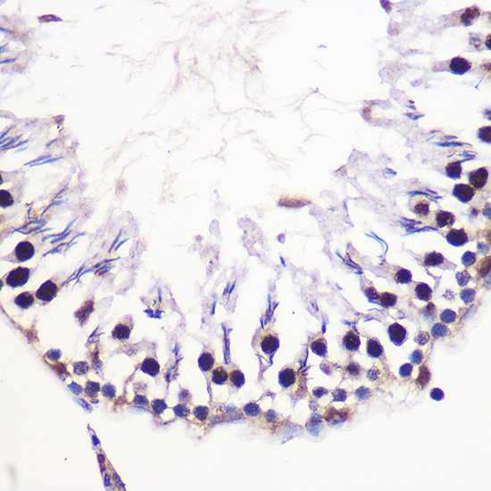 Histone H2AFV Rabbit polyclonal antibody