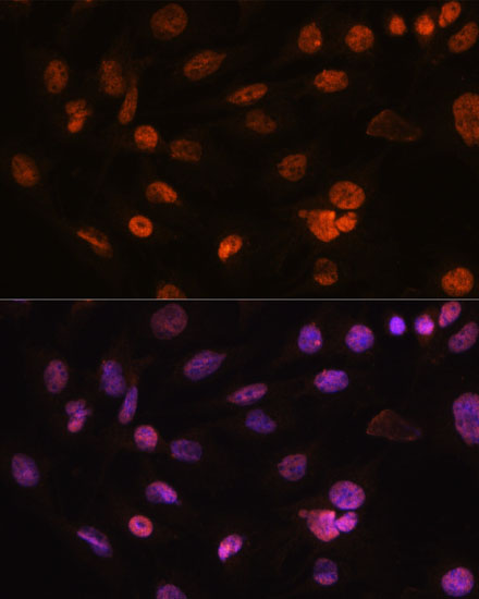 Histone H2AFV Rabbit polyclonal antibody