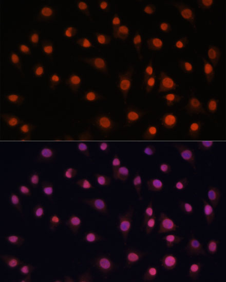 Histone H2AFV Rabbit polyclonal antibody