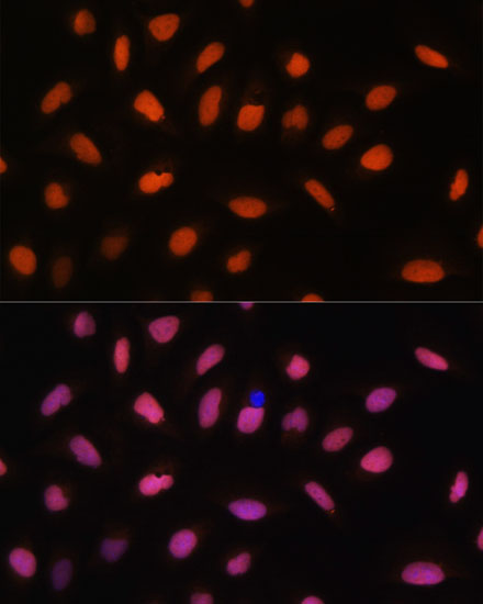 Histone H2AFV Rabbit polyclonal antibody