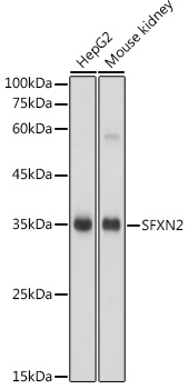 SFXN2 Rabbit polyclonal antibody
