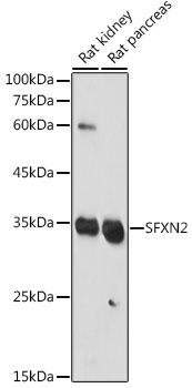 SFXN2 Rabbit polyclonal antibody