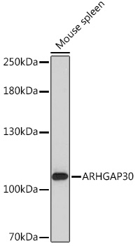 ARHGAP30 Rabbit polyclonal antibody