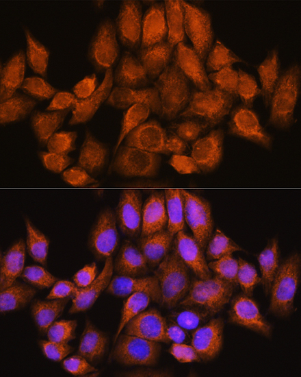 ARHGAP30 Rabbit polyclonal antibody