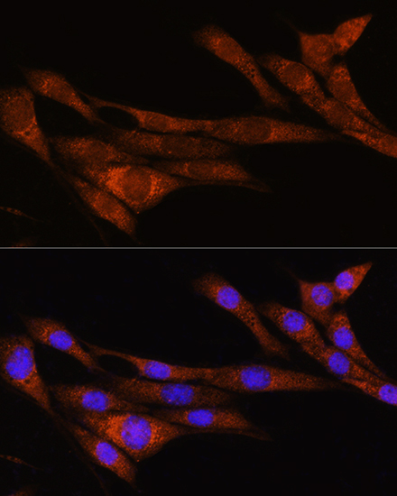 ARHGAP30 Rabbit polyclonal antibody