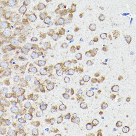 eEF1A1 Rabbit polyclonal antibody