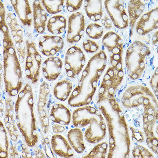 eEF1A1 Rabbit polyclonal antibody