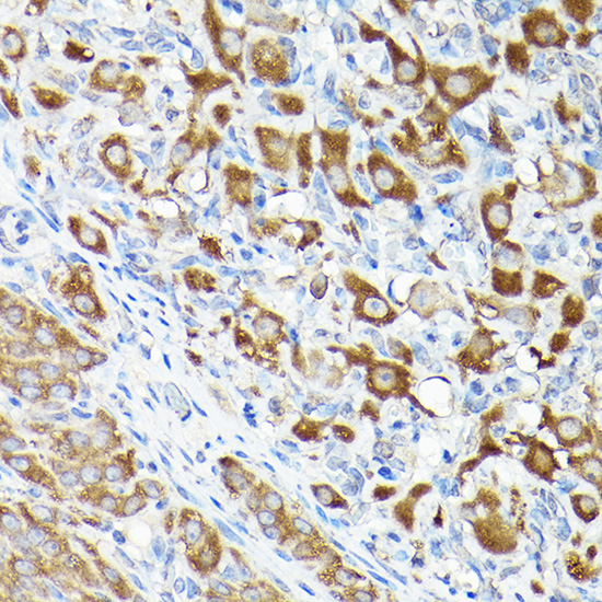 eEF1A1 Rabbit polyclonal antibody