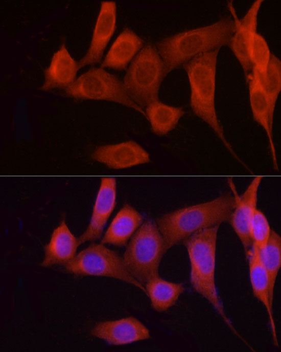 FGF17 Rabbit polyclonal antibody