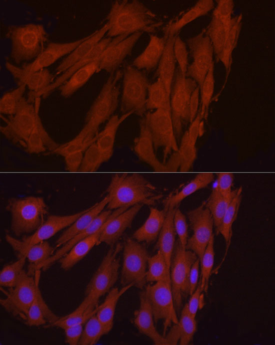 FGF17 Rabbit polyclonal antibody