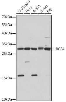 RGS4 Rabbit polyclonal antibody