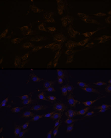 RGS4 Rabbit polyclonal antibody
