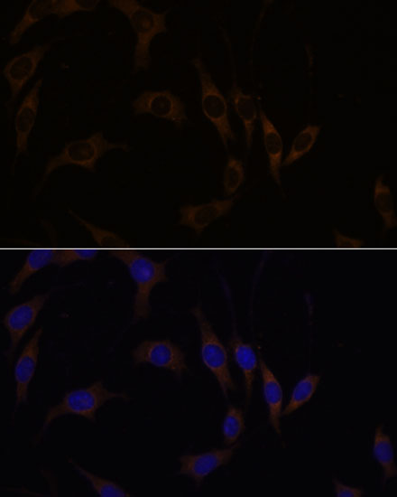 RGS4 Rabbit polyclonal antibody