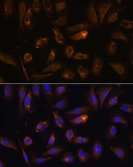 RGS4 Rabbit polyclonal antibody
