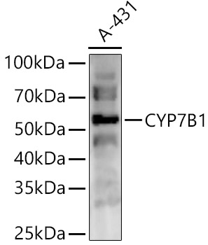 CYP7B1 Rabbit polyclonal antibody