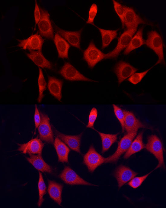CYP7B1 Rabbit polyclonal antibody