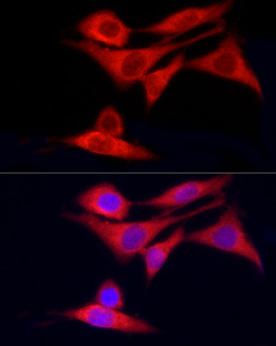 CYP7B1 Rabbit polyclonal antibody