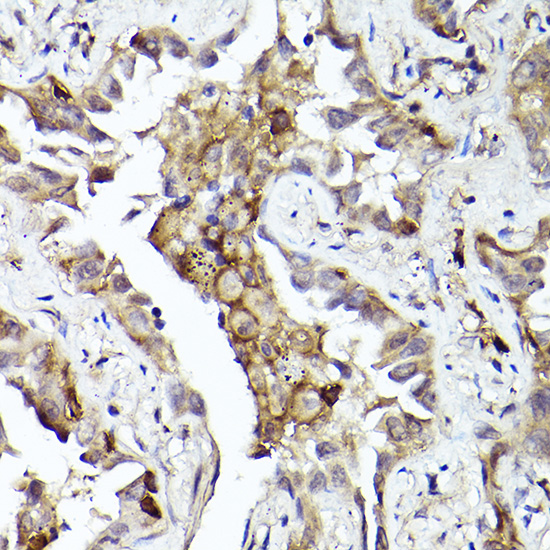 Axl Rabbit polyclonal antibody