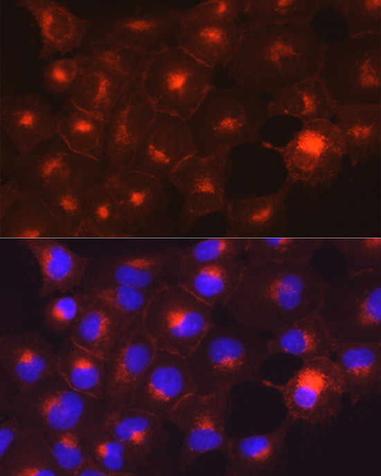 Axl Rabbit polyclonal antibody