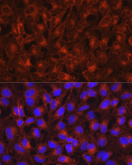 Axl Rabbit polyclonal antibody
