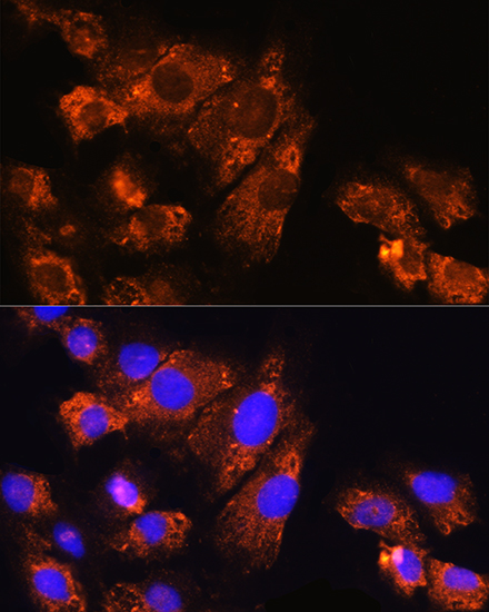 Enpp1 Rabbit polyclonal antibody