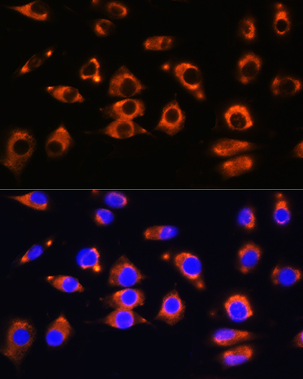 Enpp1 Rabbit polyclonal antibody