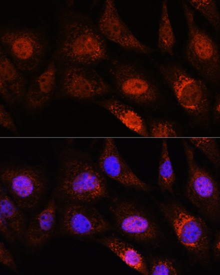 ZC3H12D Rabbit polyclonal antibody