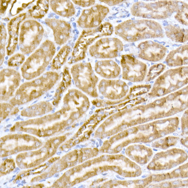 MTCO1 Rabbit polyclonal antibody