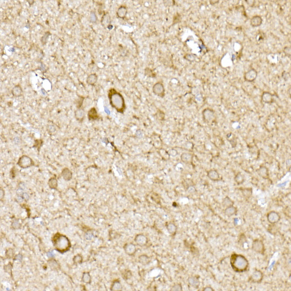MTCO1 Rabbit polyclonal antibody