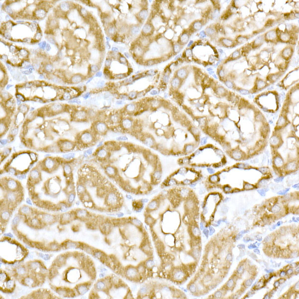 MTCO1 Rabbit polyclonal antibody