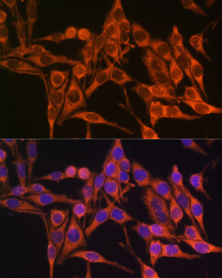 MT-ATP8 Rabbit polyclonal antibody