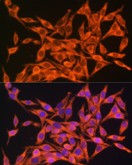 MT-ATP8 Rabbit polyclonal antibody