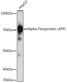 Alpha-Fetoprotein (AFP) Mouse monoclonal antibody