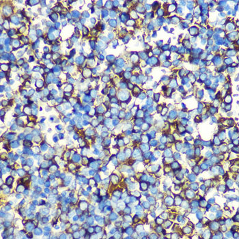 Alpha-Fetoprotein (AFP) Mouse monoclonal antibody