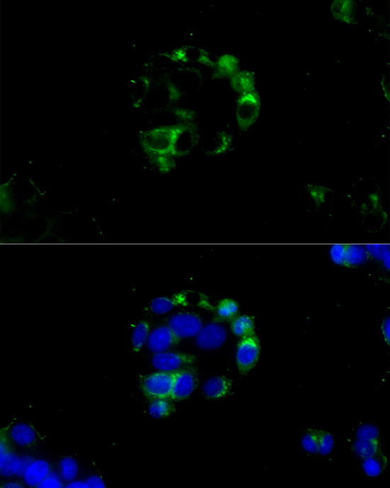 Alpha-Fetoprotein (AFP) Mouse monoclonal antibody