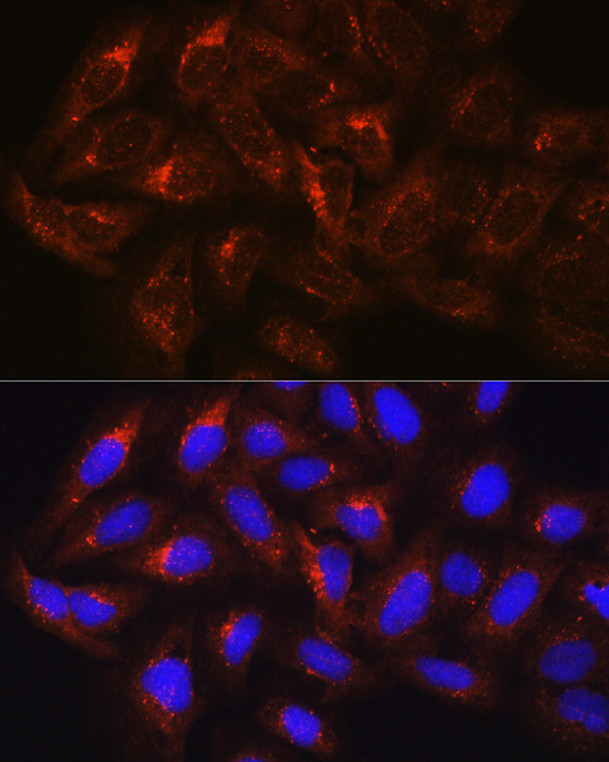 HGS Rabbit polyclonal antibody