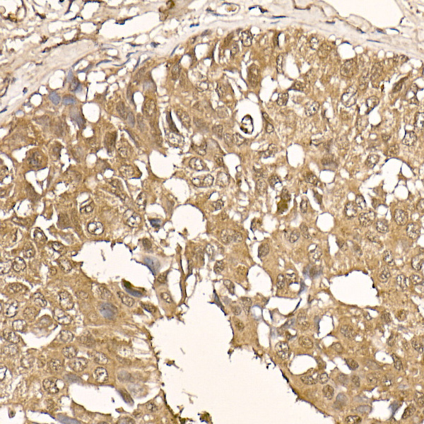 AKT1 Rabbit monoclonal antibody