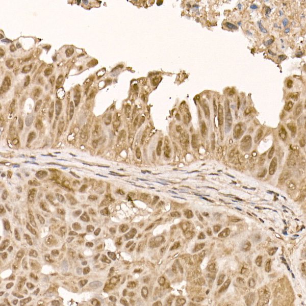 AKT1 Rabbit monoclonal antibody
