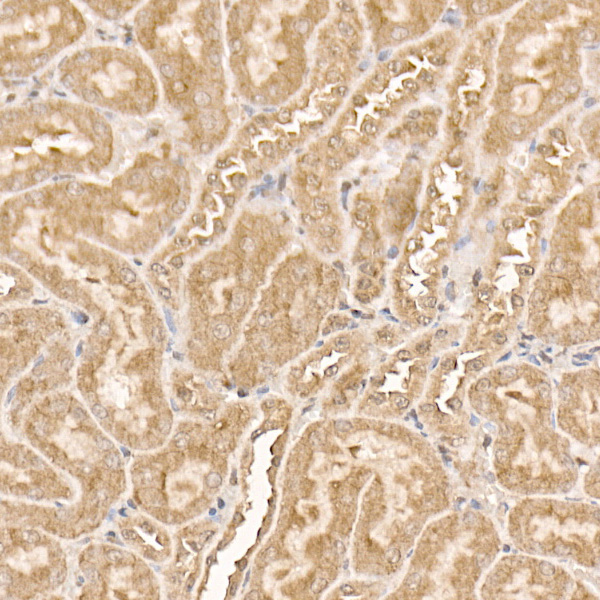 AKT1 Rabbit monoclonal antibody