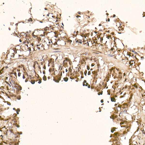AKT1 Rabbit monoclonal antibody