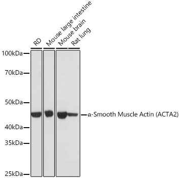 A Alpha-Smooth Muscle Actin (ACTA2) Rabbit monoclonal antibody