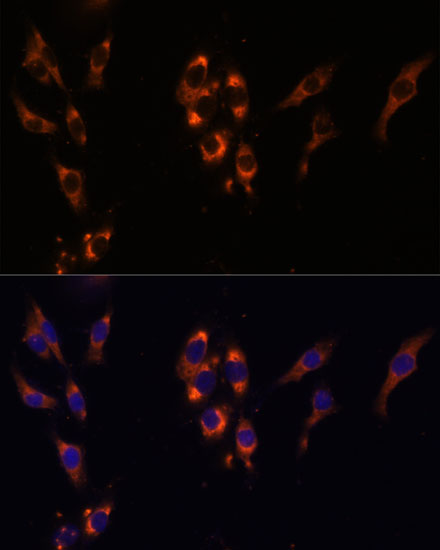 PDE3A Rabbit polyclonal antibody
