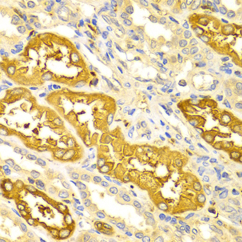 BIN1 Rabbit polyclonal antibody