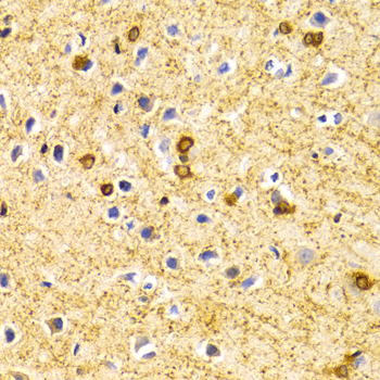 BIN1 Rabbit polyclonal antibody