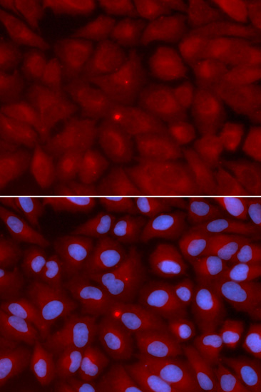 BIN1 Rabbit polyclonal antibody