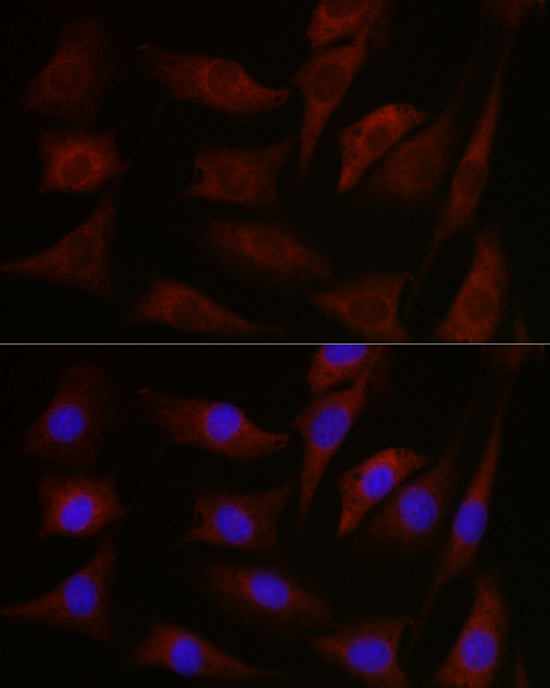 pan-PKC Rabbit polyclonal antibody