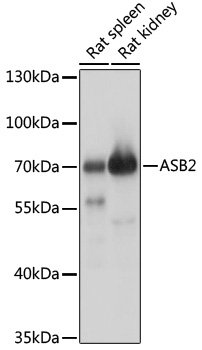 ASB2 Rabbit polyclonal antibody