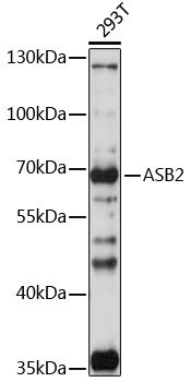 ASB2 Rabbit polyclonal antibody