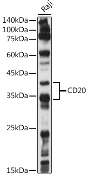 CD20 Rabbit polyclonal antibody