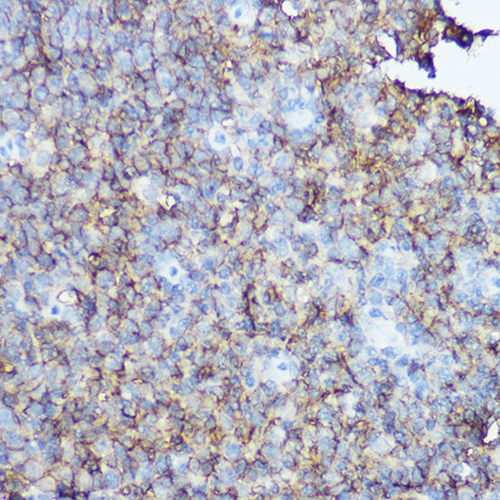 CD20 Rabbit polyclonal antibody